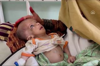 Hlad v Afghánistánu: Ohroženy jsou miliony dětí. Pomoc vázne a posiluje Islámský stát - Novinky